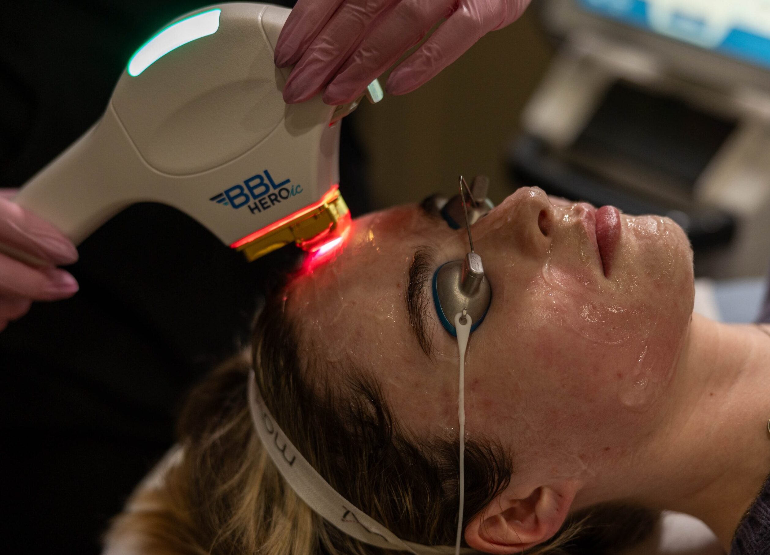 Foreverclear Before and after